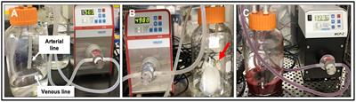 Analysis of Vascular Architecture and Parenchymal Damage Generated by Reduced Blood Perfusion in Decellularized Porcine Kidneys Using a Gray Level Co-occurrence Matrix